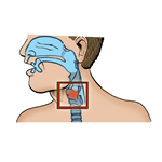 Membrane qui couvre les amygdales, la partir postérieure de la gorge (farynx) et/ou le nez et empêche la respiration